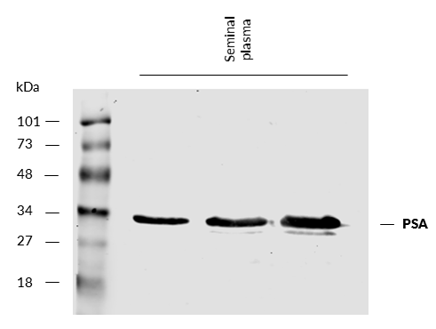 PSA Antibody