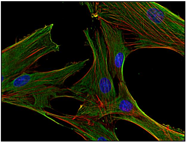 Clathrin Heavy Chain Antibody