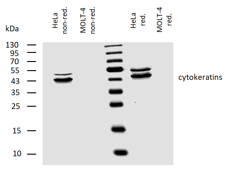 Cytokeratins Antibody