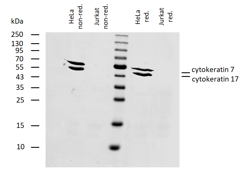 Cytokeratin 7/17 Antibody