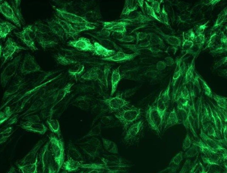 Cytokeratin 8 Antibody