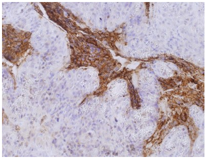 CD66e Antibody