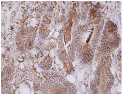 CD66e Antibody