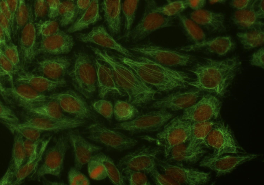 Cytokeratin 18 Antibody