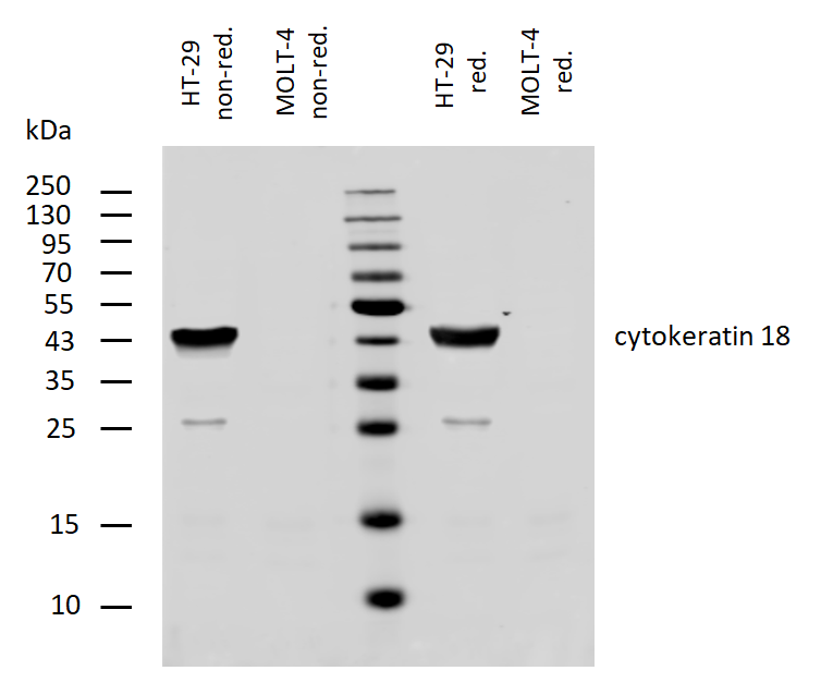 Cytokeratin 18 Antibody