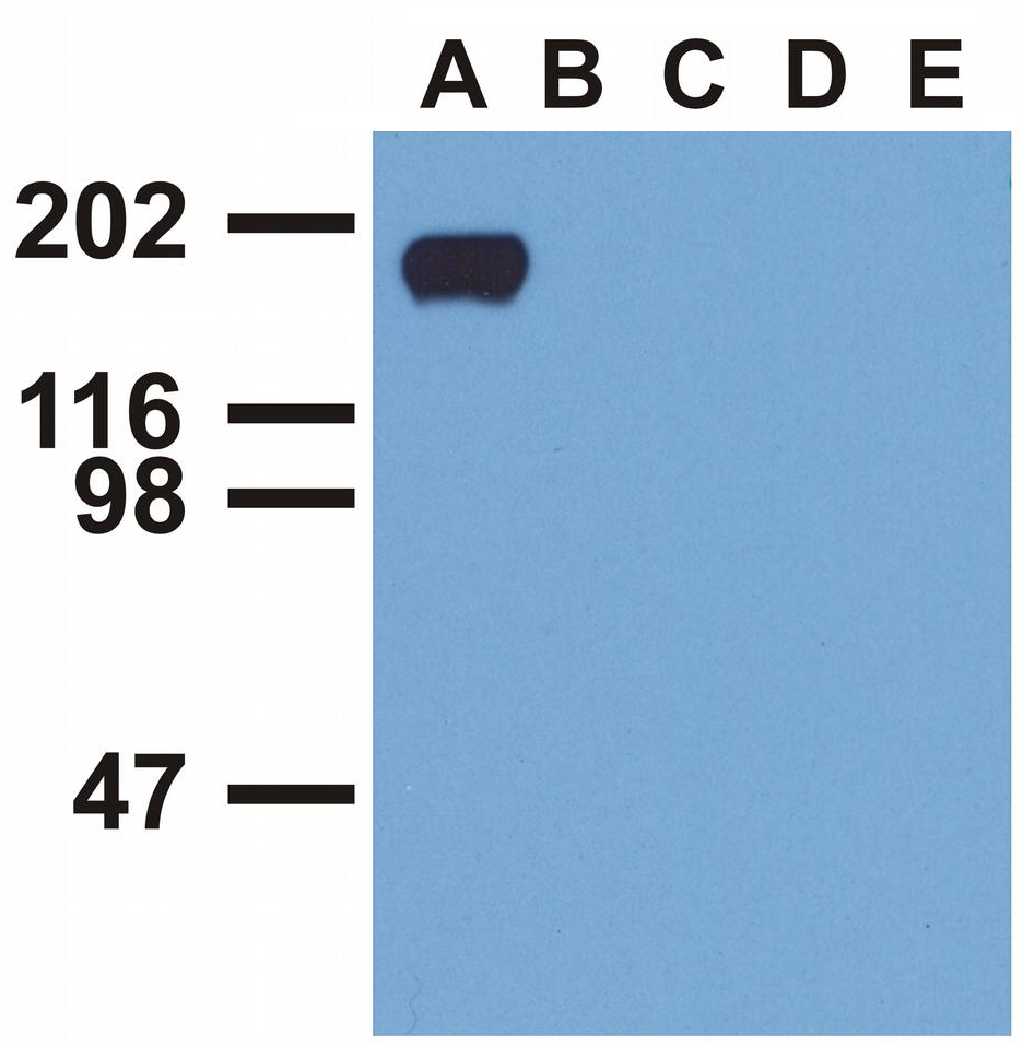 EGFR (pY992) Antibody