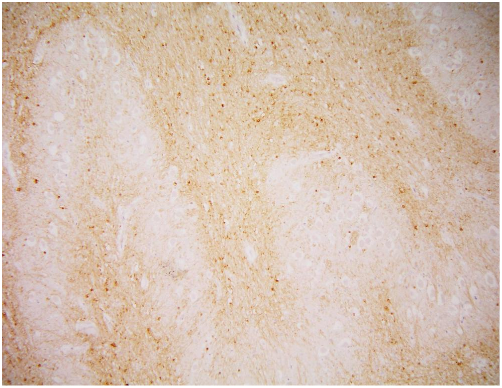 PSMA Antibody