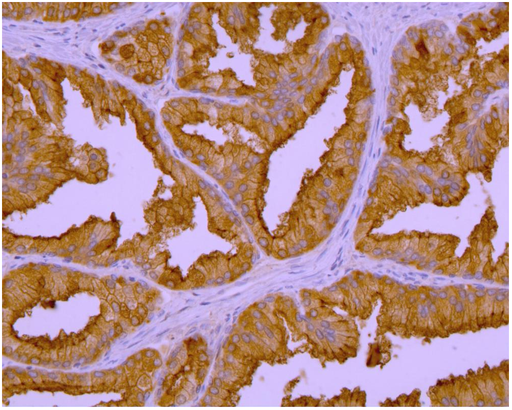 PSMA Antibody