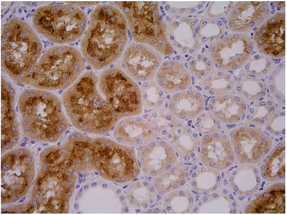 PSMA Antibody