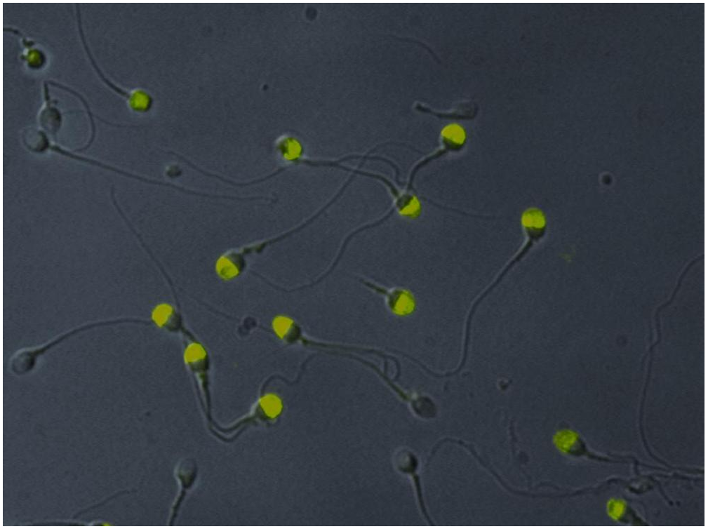 VCP Antibody