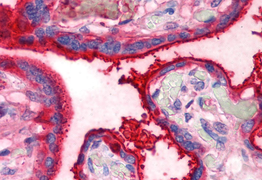 Transferrin Antibody
