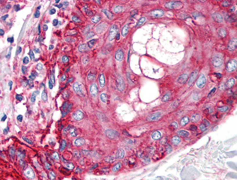 CD59 Antibody
