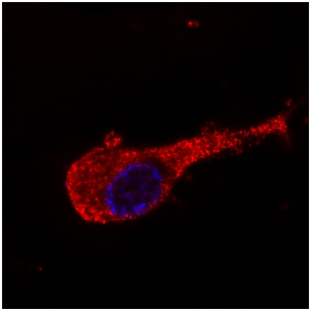 Neurofilament M Antibody