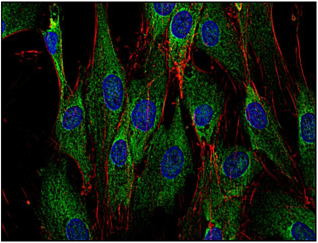 SOS Antibody