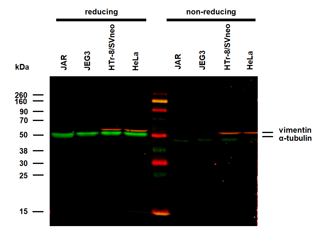 Vimentin Antibody