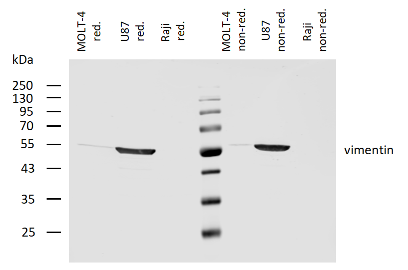 Vimentin Antibody
