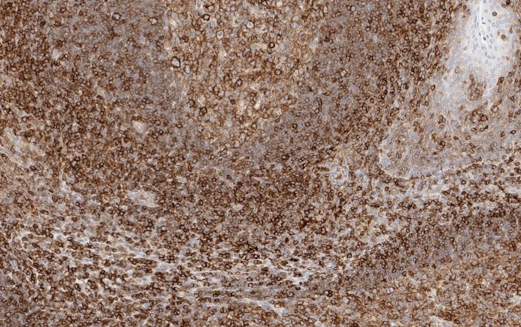 Mouse Human HLA Class I Heavy Chain (Restricted expression) Antibody
