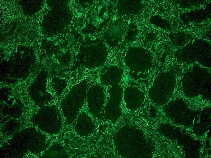 Recombinant mouse vimentin Antibody