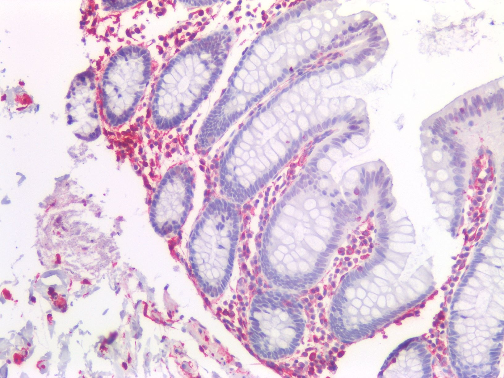 Recombinant mouse vimentin Antibody