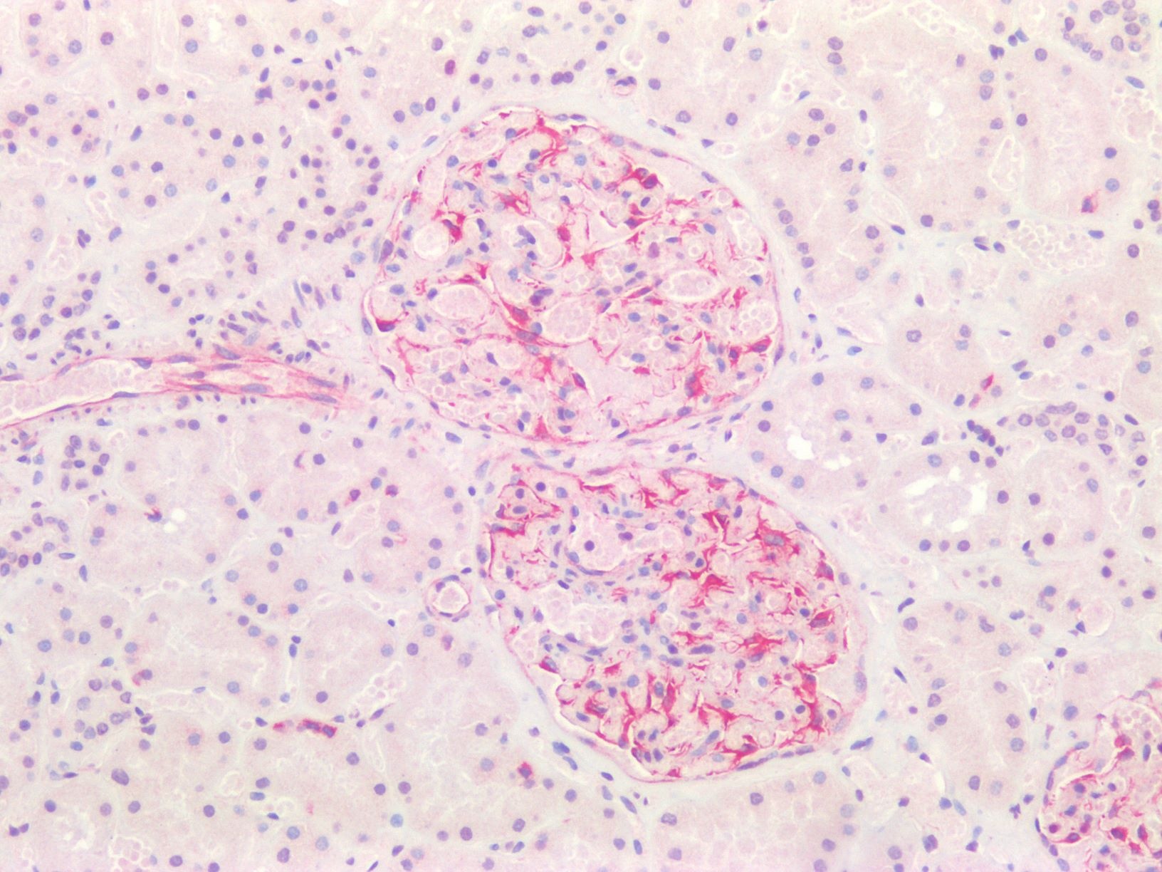 Recombinant mouse vimentin Antibody