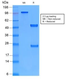 Recombinant rabbit vimentin Antibody