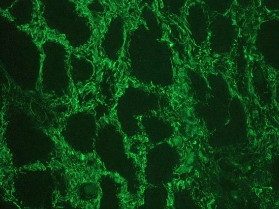 Recombinant rabbit vimentin Antibody