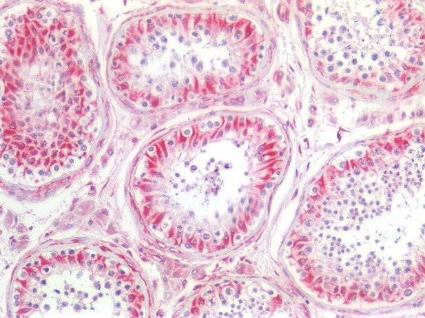 Recombinant rabbit vimentin Antibody