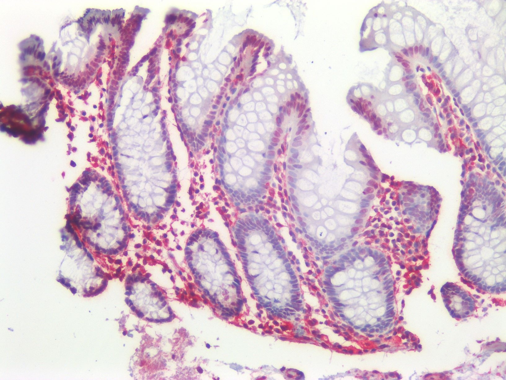 Recombinant rabbit vimentin Antibody