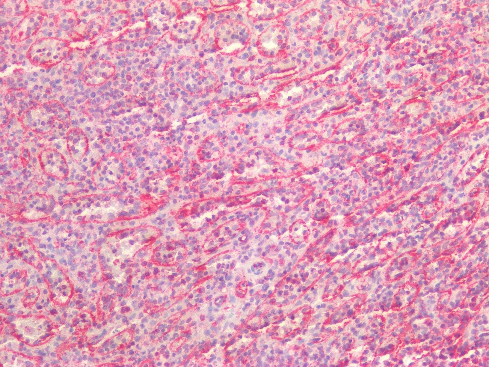 Recombinant rabbit vimentin Antibody