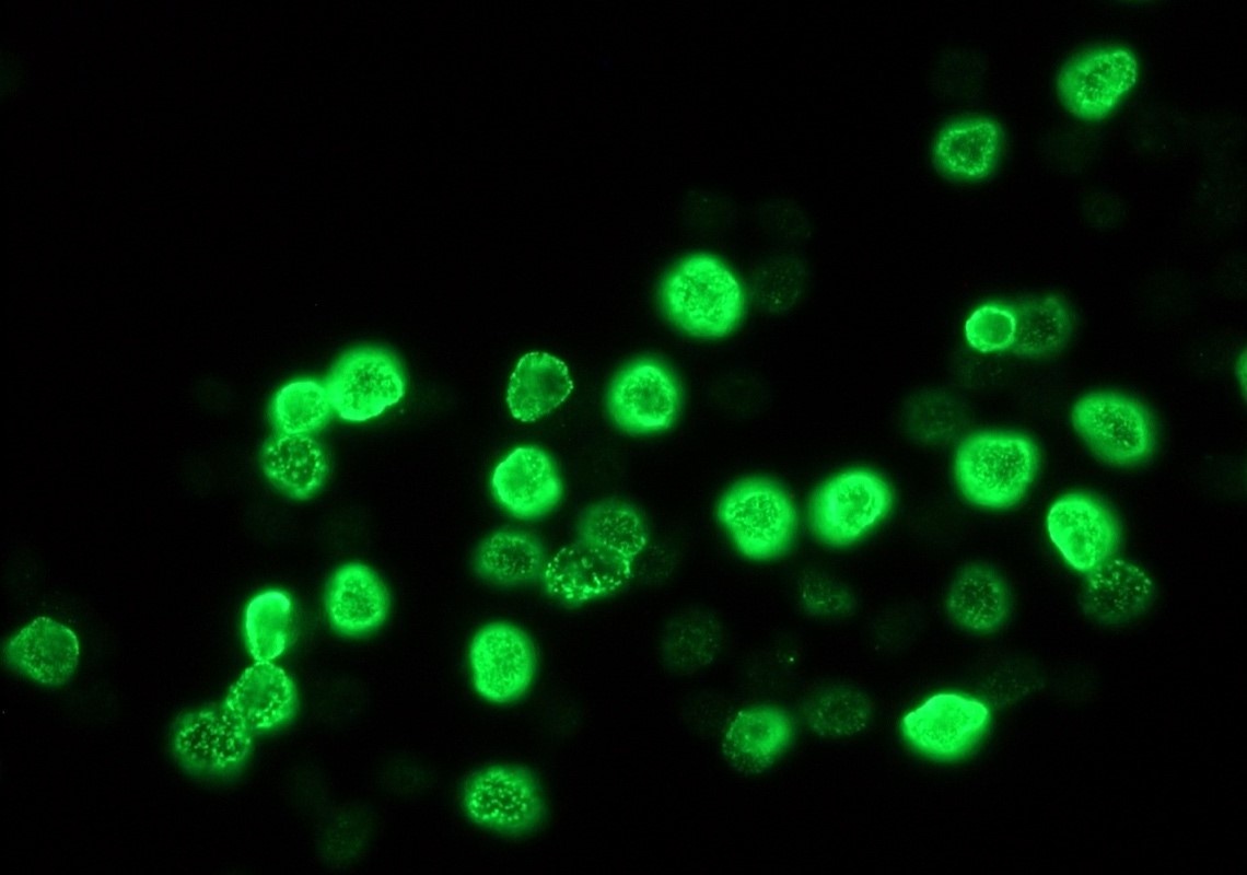 Mouse Bromodeoxyuridine / BrdU Antibody