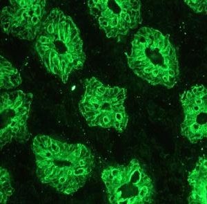 Mouse Cytokeratin 18 / Keratin K18 Antibody
