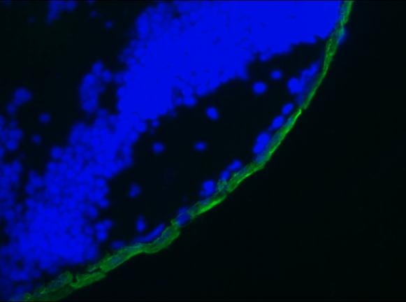 Mouse Cytokeratin 19 / Keratin K19 Antibody