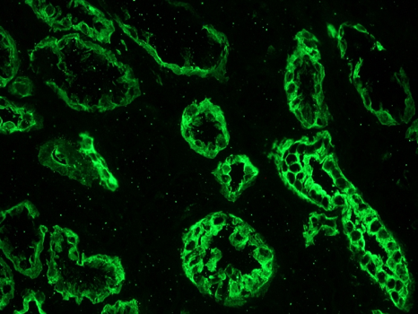 Mouse Cytokeratin 19 / Keratin K19 Antibody