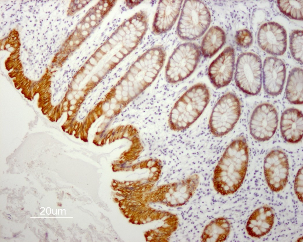Mouse Cytokeratin 19 / Keratin K19 Antibody