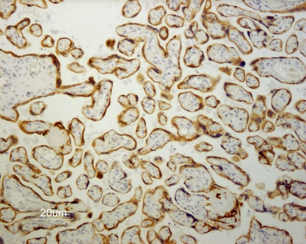 Mouse Cytokeratin 19 / Keratin K19 Antibody