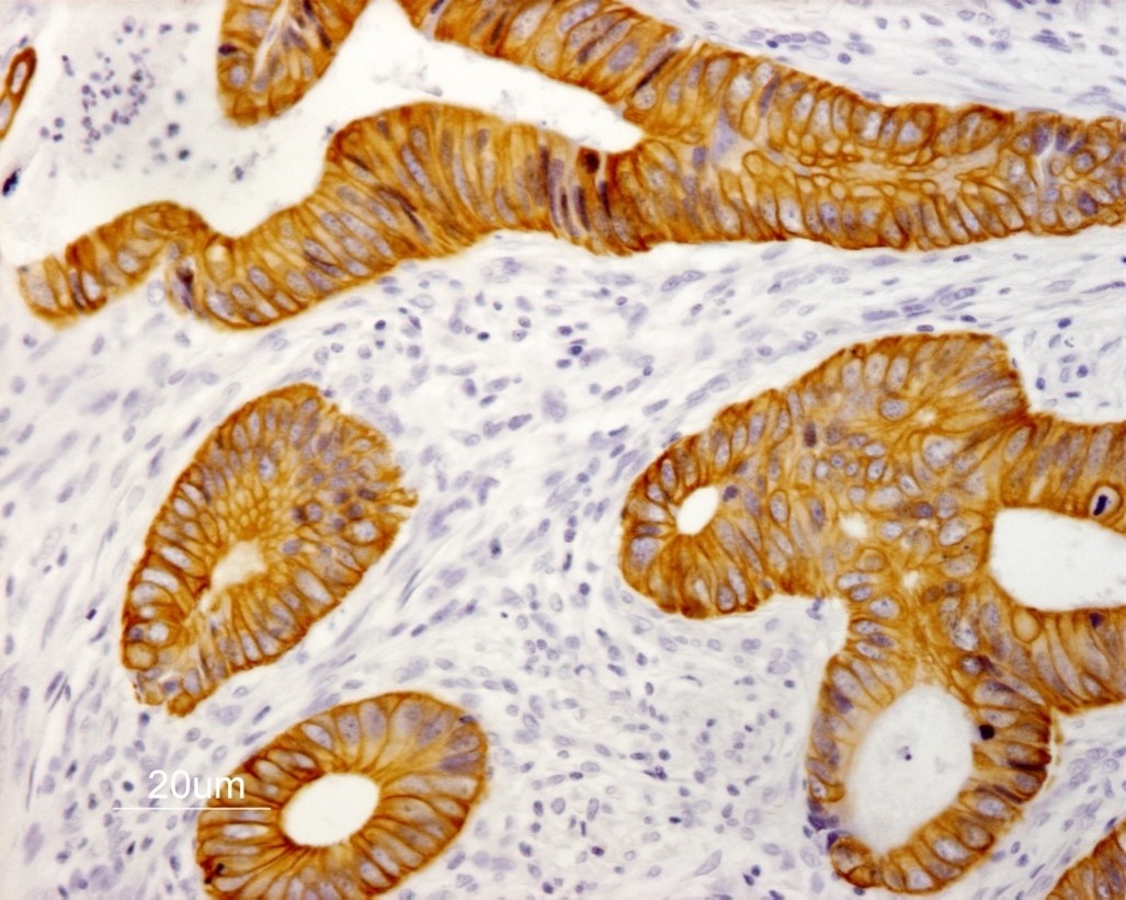 Mouse Cytokeratin 19 / Keratin K19 Antibody