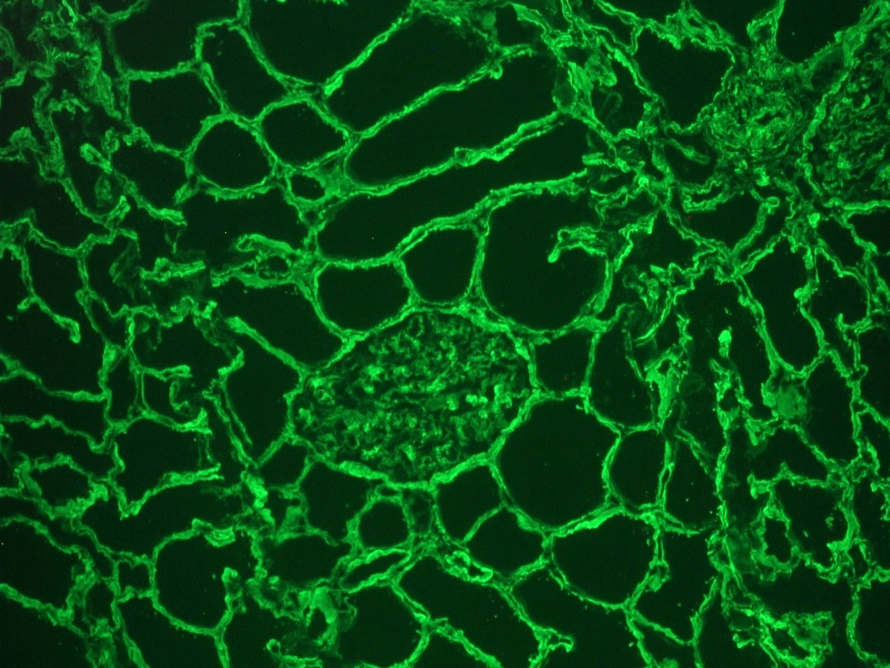Rabbit Collagen IV Antibody