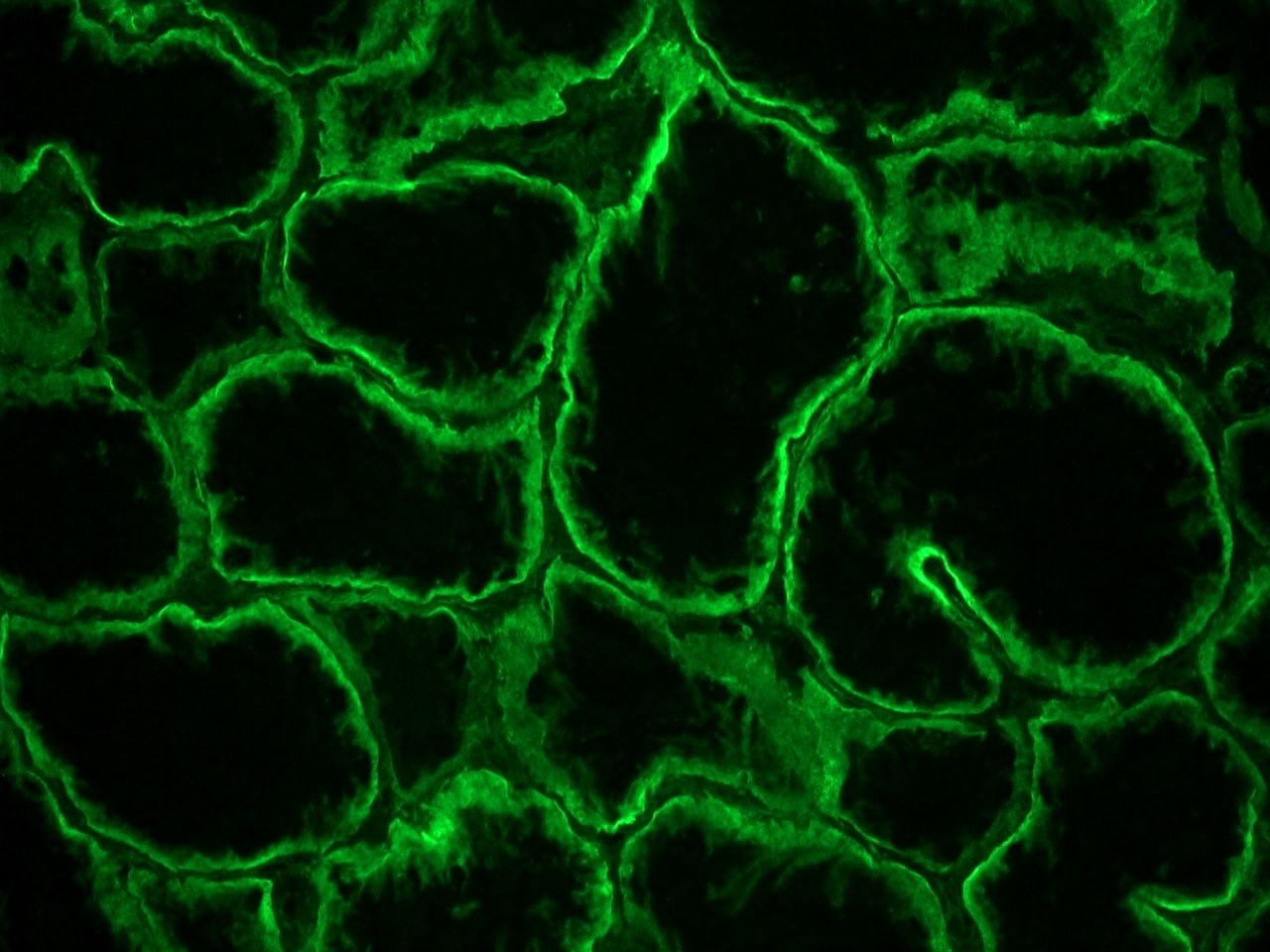 Rat Integrin alpha 6A / CD49f Antibody