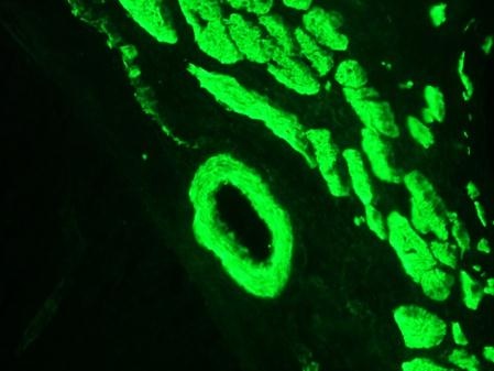 Mouse Smoothelin Antibody