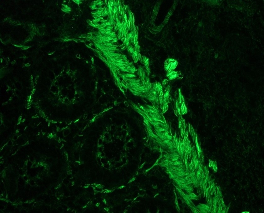 Mouse Smoothelin Antibody