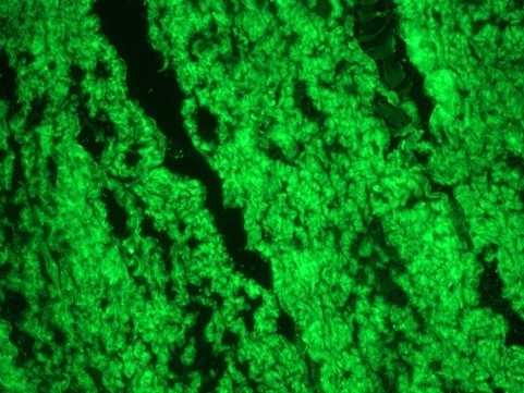 Mouse Smoothelin Antibody
