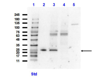 Recombinant GST Antibody