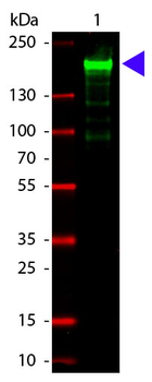 Alpha-2-Macroglobulin Antibody