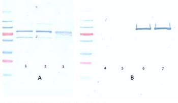 AKT phospho S473 Antibody