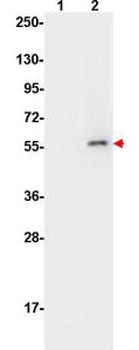 AKT phospho S473 Antibody