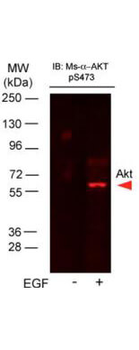 AKT phospho S473 Antibody