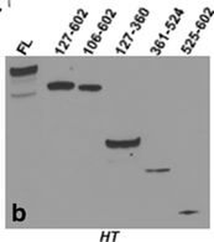 6X His Epitope Tag Antibody