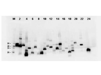 DYKDDDDK Tag (FLAG) Antibody