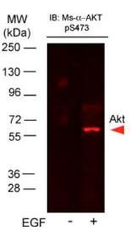 AKT phospho S473 Antibody