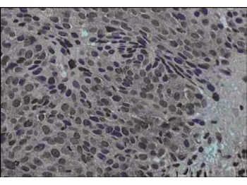 JAG1 Antibody